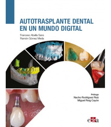 AUTOTRASPLANTE DENTAL EN UN MUNDO DIGITAL