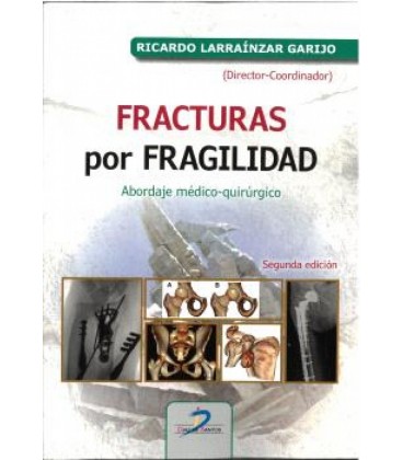 FRACTURAS POR FRAGILIDAD