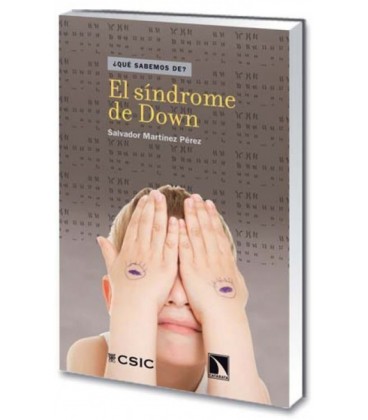 SINDROME DE DOWN