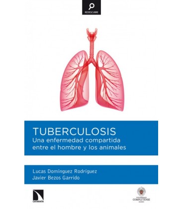 TUBERCULOSIS