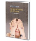 SINDROME DE DOWN