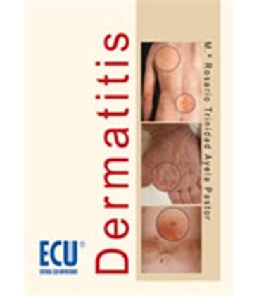 DERMATITIS