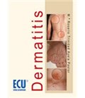 DERMATITIS