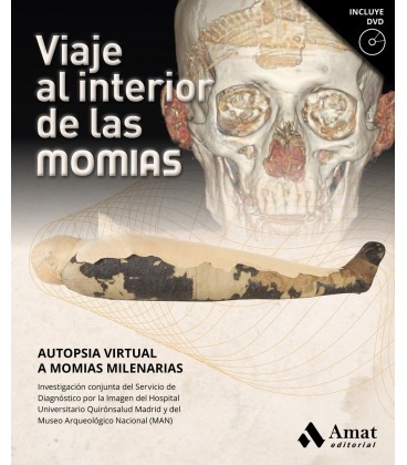 VIAJE AL INTERIOR DE LAS MOMIAS