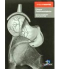 CHOQUE FEMOROACETABULAR