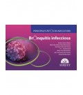 BRONQUITIS INFECCIOSAS PRINCIPALES RETOS DE AVICULTURA