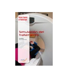 SIMULACION DEL TRATAMIENTO