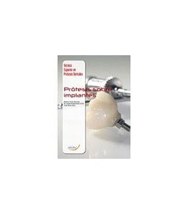 PROTESIS SOBRE IMPLANTES