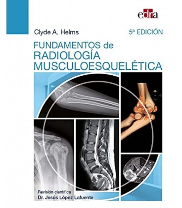 FUNDAMENTOS DE RADIOLOGIA MUSCULOESQUELETICA (5ED)