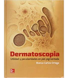 DERMATOSCOPIA UTILIDAD Y PECULIARIDADES EN PIEL PIGMENTADA