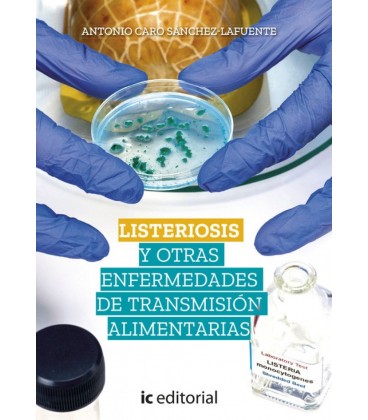 LISTERIOSIS Y OTRAS ENFERMEDADES DE TRANSMISION ALIMENTARIAS